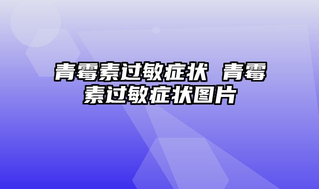 青霉素过敏症状 青霉素过敏症状图片