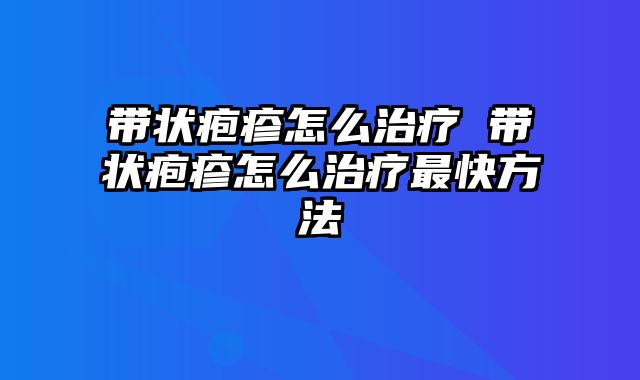 带状疱疹怎么治疗 带状疱疹怎么治疗最快方法