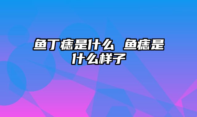 鱼丁痣是什么 鱼痣是什么样子