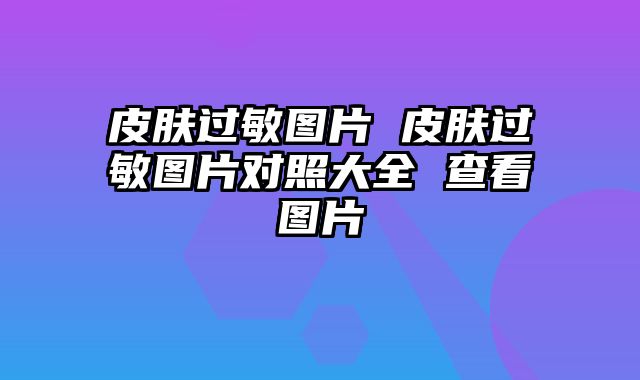皮肤过敏图片 皮肤过敏图片对照大全 查看图片