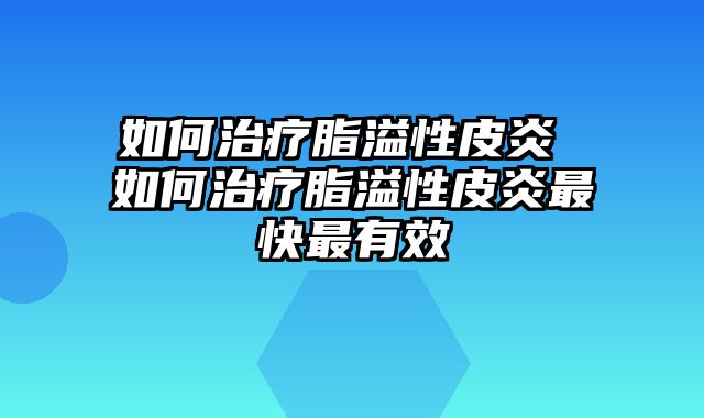如何治疗脂溢性皮炎 如何治疗脂溢性皮炎最快最有效