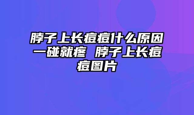 脖子上长痘痘什么原因一碰就疼 脖子上长痘痘图片