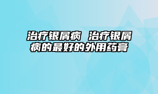 治疗银屑病 治疗银屑病的最好的外用药膏