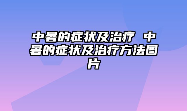 中暑的症状及治疗 中暑的症状及治疗方法图片