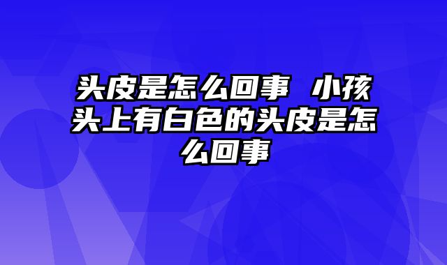 头皮是怎么回事 小孩头上有白色的头皮是怎么回事