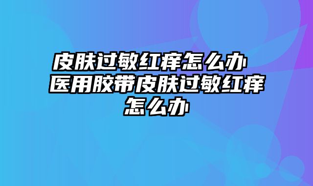 皮肤过敏红痒怎么办 医用胶带皮肤过敏红痒怎么办