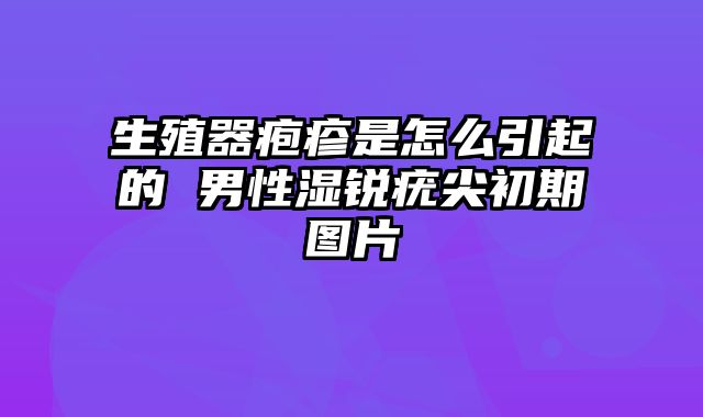 生殖器疱疹是怎么引起的 男性湿锐疣尖初期图片