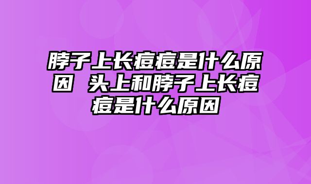 脖子上长痘痘是什么原因 头上和脖子上长痘痘是什么原因