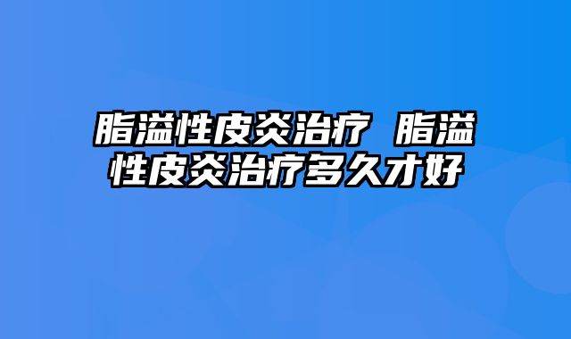 脂溢性皮炎治疗 脂溢性皮炎治疗多久才好