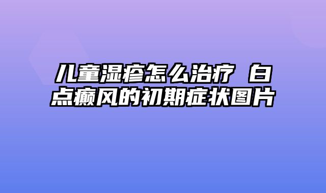 儿童湿疹怎么治疗 白点癫风的初期症状图片