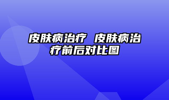 皮肤病治疗 皮肤病治疗前后对比图