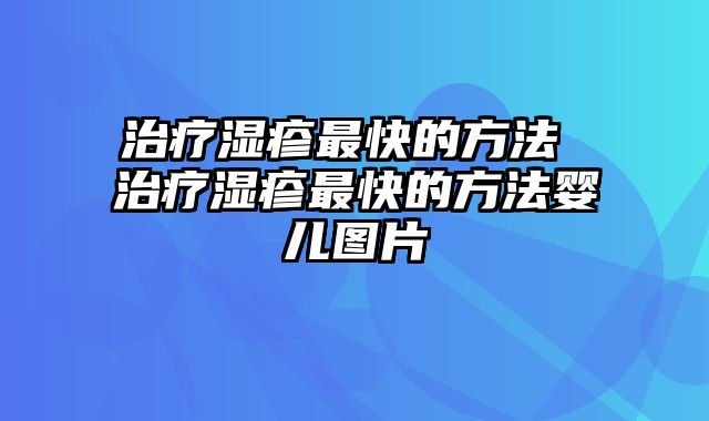 治疗湿疹最快的方法 治疗湿疹最快的方法婴儿图片