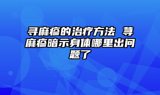 寻麻疹的治疗方法 荨麻疹暗示身体哪里出问题了
