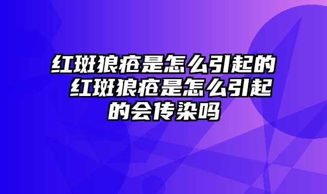 红斑狼疮是怎么引起的 红斑狼疮是怎么引起的会传染吗