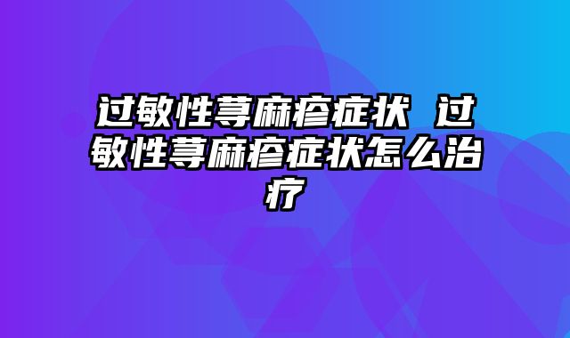 过敏性荨麻疹症状 过敏性荨麻疹症状怎么治疗