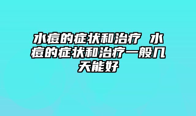水痘的症状和治疗 水痘的症状和治疗一般几天能好