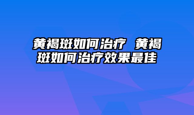 黄褐斑如何治疗 黄褐斑如何治疗效果最佳