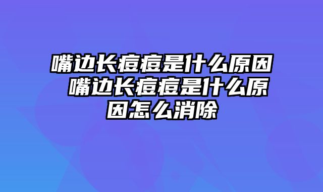 嘴边长痘痘是什么原因 嘴边长痘痘是什么原因怎么消除