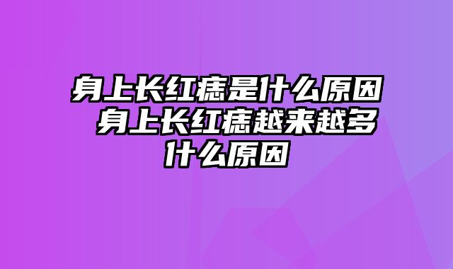 身上长红痣是什么原因 身上长红痣越来越多什么原因