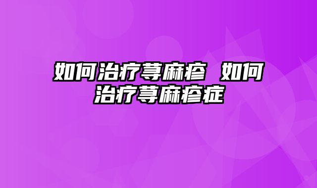 如何治疗荨麻疹 如何治疗荨麻疹症