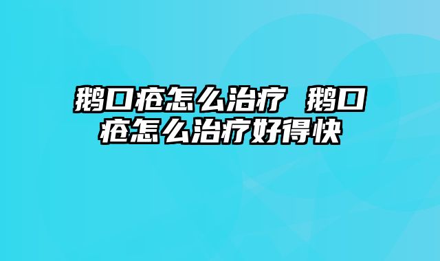 鹅口疮怎么治疗 鹅口疮怎么治疗好得快