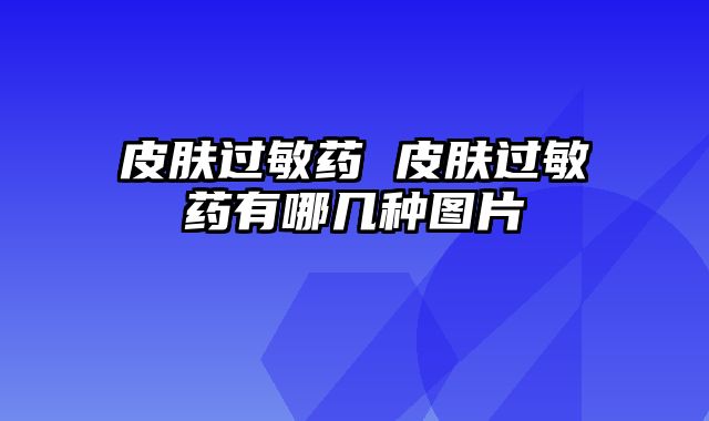 皮肤过敏药 皮肤过敏药有哪几种图片