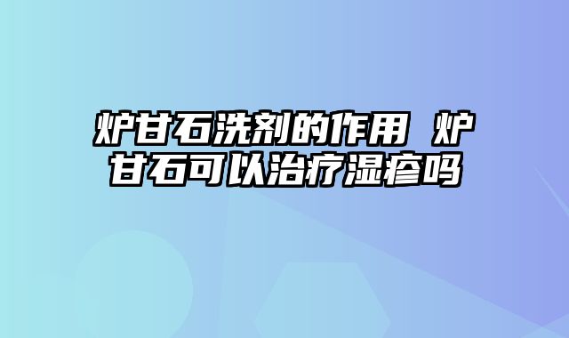 炉甘石洗剂的作用 炉甘石可以治疗湿疹吗