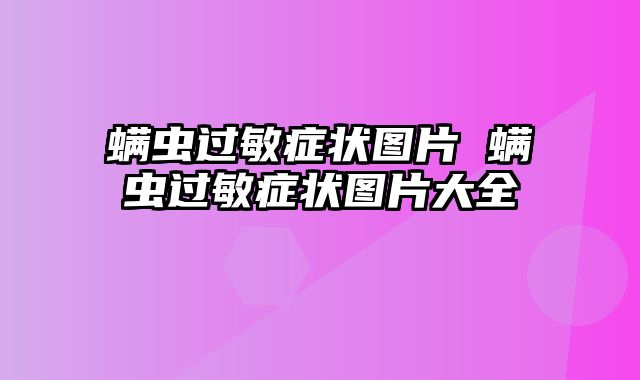 螨虫过敏症状图片 螨虫过敏症状图片大全