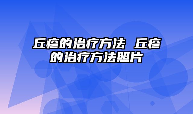 丘疹的治疗方法 丘疹的治疗方法照片