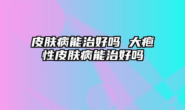 皮肤病能治好吗 大疱性皮肤病能治好吗