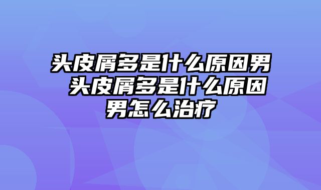 头皮屑多是什么原因男 头皮屑多是什么原因男怎么治疗
