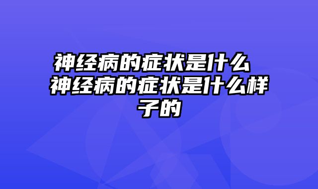 神经病的症状是什么 神经病的症状是什么样子的
